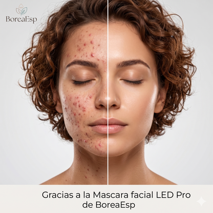 Borea - Máscara facial LED Pro